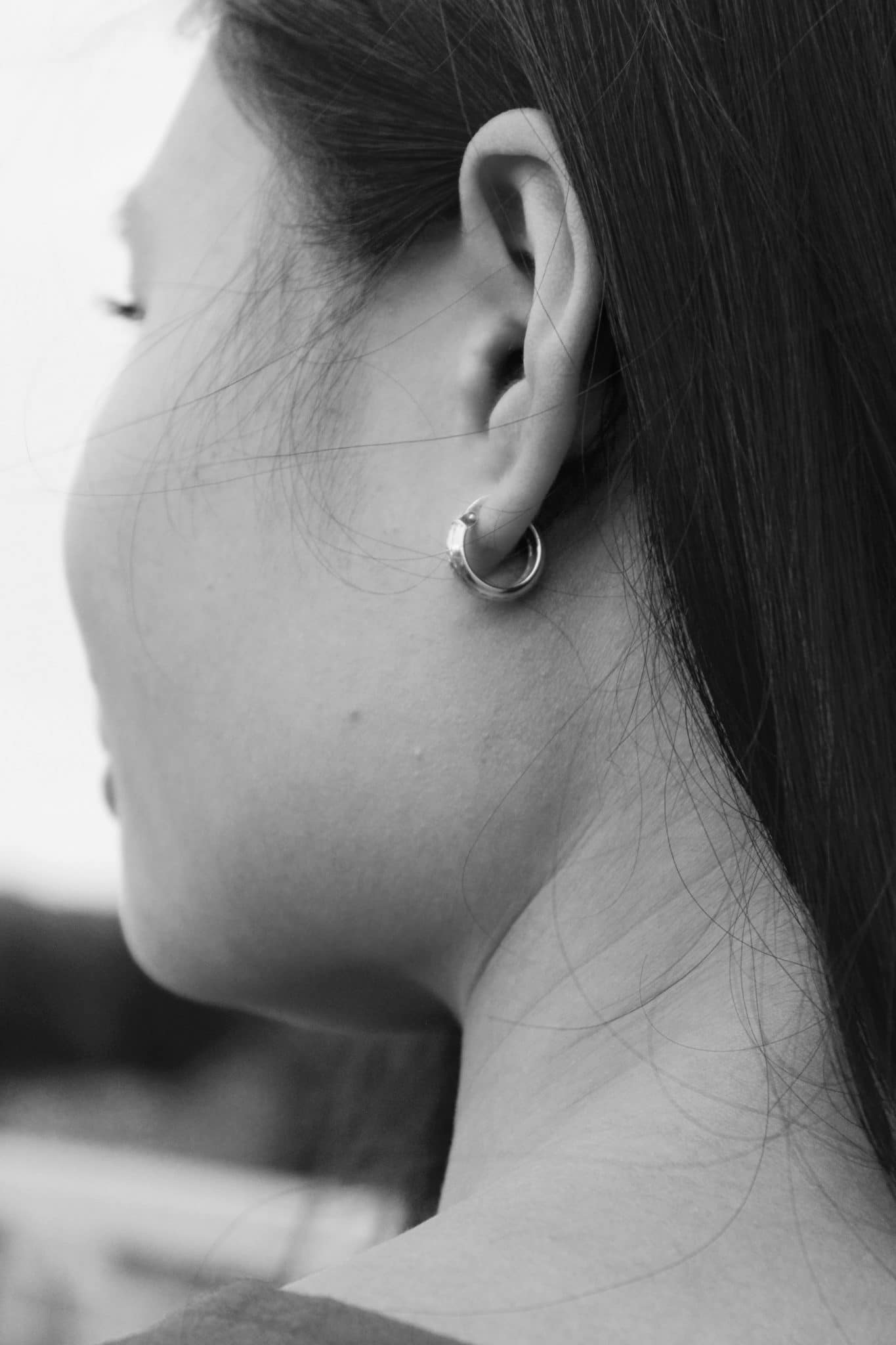 Embedded Earrings Removal in SG - Aurion ENT & Hearing Centre