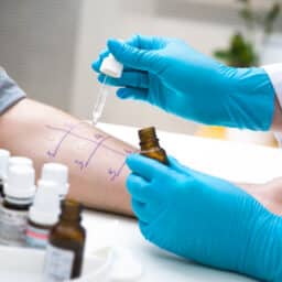 Provider administering an allergy skin test